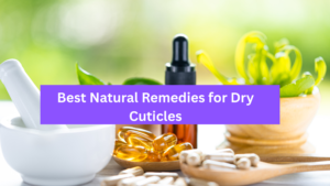Why Are My Cuticles Always Dry? Causes, Treatments & Prevention Guide