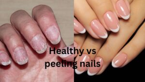 Why do my nails peel after nail polish? 8 Common Causes & Easy Fixes