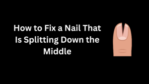 Why Do My Nails Split Down the Middle? Causes, Treatment & Prevention