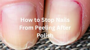 Why do my nails peel after nail polish? 8 Common Causes & Easy Fixes