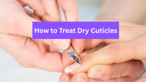 Why Are My Cuticles Always Dry? Causes, Treatments & Prevention Guide