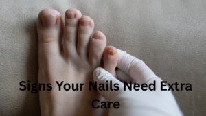 Why Do My Nails Break Easily? 15 Common Causes and Simple Ways to Make Them Stronger