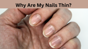 Why Are My Nails Thin? Expert Tips to Make Weak Nails Strong Again