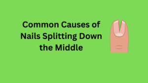 Why Do My Nails Split Down the Middle? Causes, Treatment & Prevention