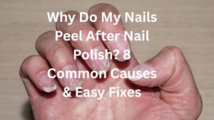 Why do my nails peel after nail polish? 8 Common Causes & Easy Fixes