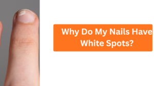 Why Do My Nails Have White Spots