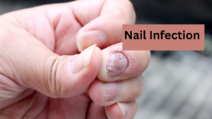Why Do My Nails Hurt? 9 Common Causes and What to Do