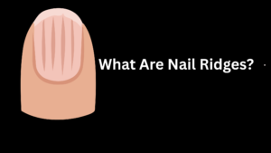 Why do my nails have ridges? Discover what causes vertical and horizontal nail ridges, how to improve nail health, and when to see a doctor.
