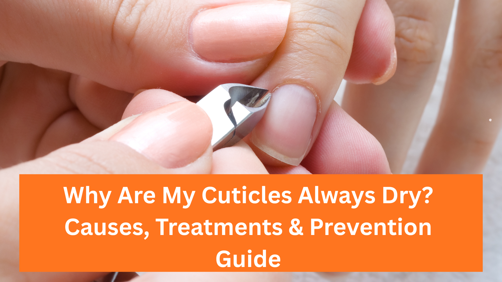 Why Are My Cuticles Always Dry? Causes, Treatments & Prevention Guide