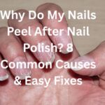 Why do my nails peel after nail polish? 8 Common Causes & Easy Fixes