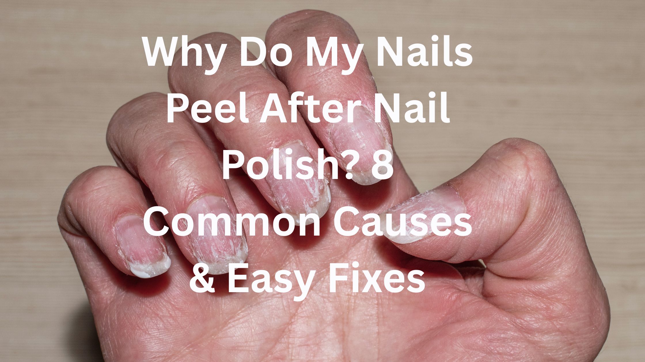 Why do my nails peel after nail polish? 8 Common Causes & Easy Fixes