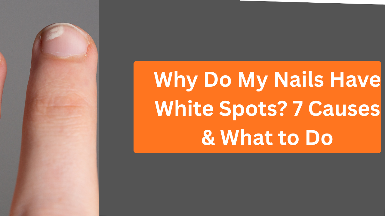 Are White Spots on Nails a Sign of Calcium Deficiency?
