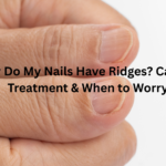 Why do my nails have ridges? Discover what causes vertical and horizontal nail ridges, how to improve nail health, and when to see a doctor.