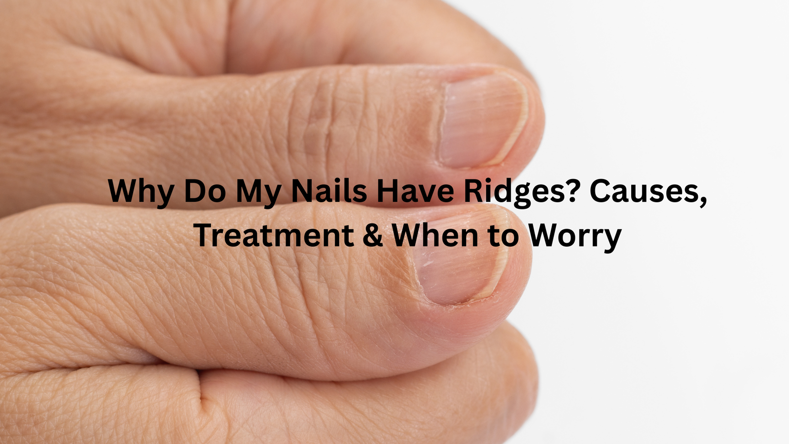 Why do my nails have ridges? Discover what causes vertical and horizontal nail ridges, how to improve nail health, and when to see a doctor.